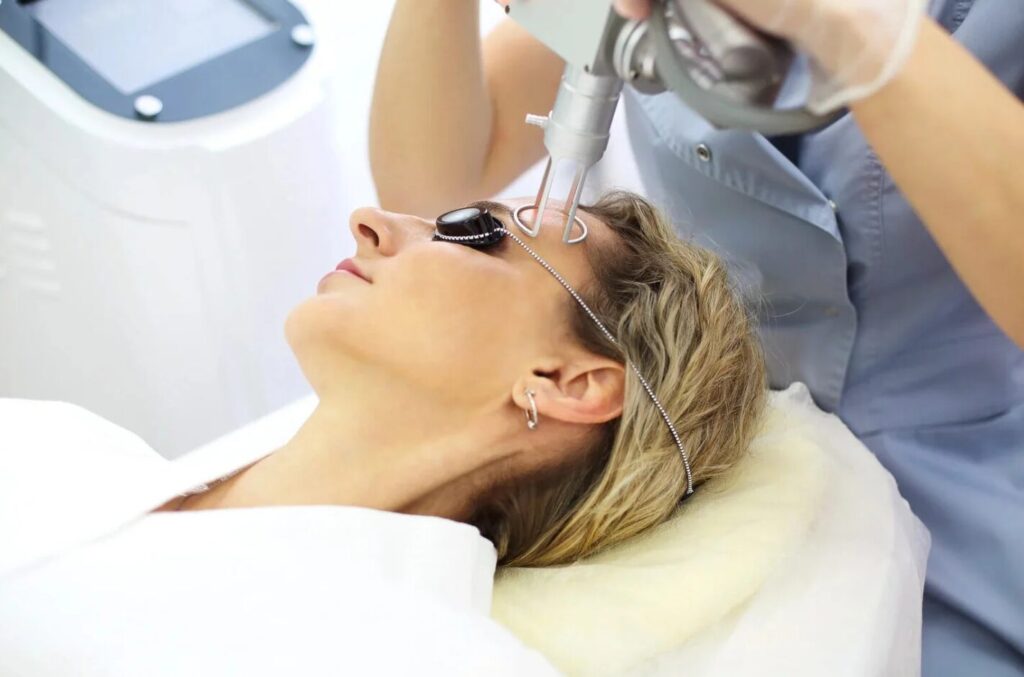 laser facial resurfacing kyiv